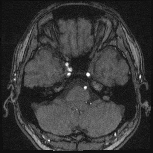 Click on the Serie image to view the images of VILLANUEVA, WILLIAM A.